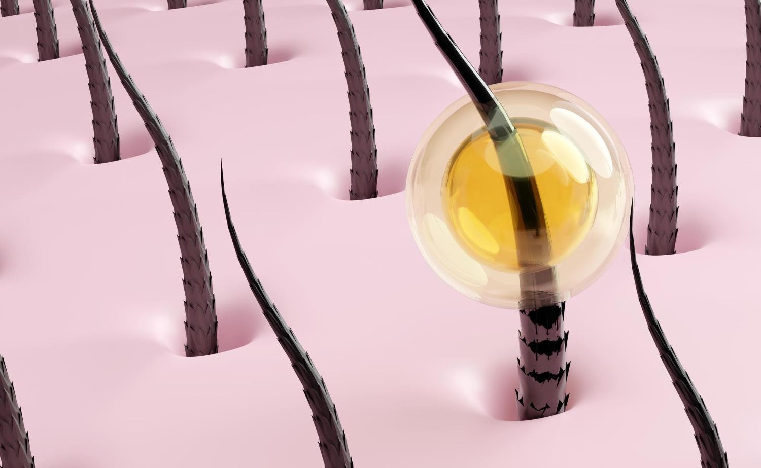 โครงสร้างรูขุมขนและรากผมที่เป็นจุดกำเนิดเส้นผมImage :&nbsp;382.jpg